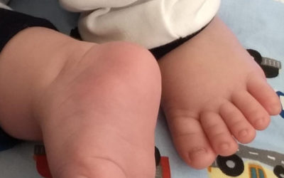 La prueba del talón en los bebés: ¿qué es y por qué se realiza a los recién nacidos?