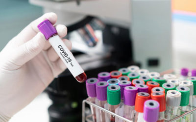He pasado el coronavirus y tengo un test que confirma que tengo un gran número de anticuerpos, ¿cómo puedo hacerme donante para ayudar a otros pacientes?