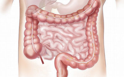 Campaña contra los bulos sobre el cáncer rectal en las redes para evitar que perjudiquen el diagnóstico precoz de la enfermedad