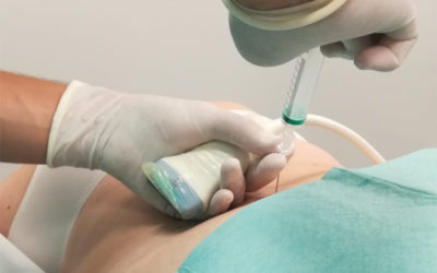 Ozonoterapia: la nueva terapia revolucionaria para tratar el dolor de numerosas patologías, por el Dr. Jonatan Pérez Toro, médico anestesiólogo