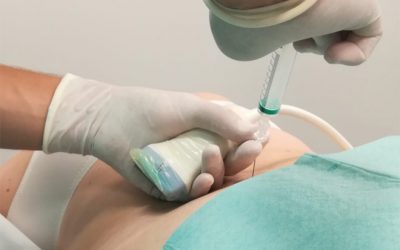 ‘En Clínica El Carmen creemos en la fibromialgia y tenemos muy buenas noticias’, por el Dr. Jonatan Pérez Toro, médico anestesiólogo
