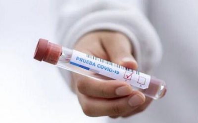 En la Clínica El Carmen de Guadalajara te ofrecemos todo tipo de test COVID para que cuides de tu salud y la de los tuyos: antígenos, PCR y serológicos